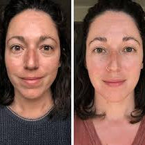 Rodillo de Crioterapia Facial — Desinfla, tonifica y rejuvenece tu piel en minutos