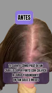 Mielle Sérum Capilar — Cabello fuerte, brillante y sin frizz desde la primera aplicación